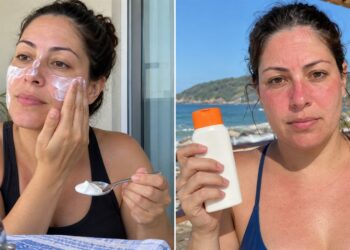 Comparação entre proteção solar e pele avermelhada pelo sol.