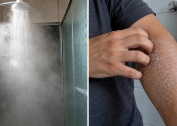 Braço com pele ressecada após o banho.